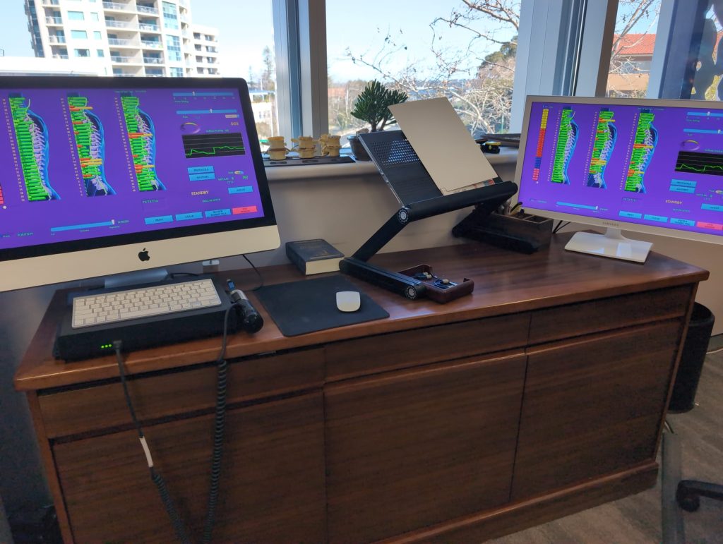 What Is Computerised Spinal Analysis? A Patient Guide